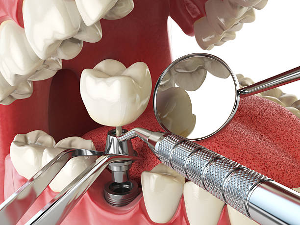 Best Knocked-Out Tooth Emergency  in Omaha, NE
